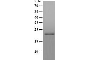 Western Blotting (WB) image for Crystallin, gamma D (CRYGD) (AA 1-174) protein (His-IF2DI Tag) (ABIN7122504)