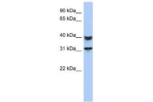 Western Blotting (WB) image for anti-Chromosome 5 Open Reading Frame 35 (C5orf35) antibody (ABIN2459640) (C5orf35 anticorps)