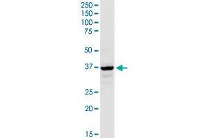 AACS MaxPab rabbit polyclonal antibody.