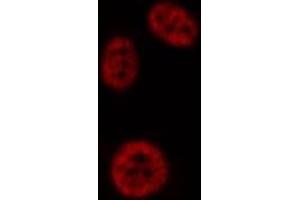 ABIN6276948 staining HepG2? (PAD4 anticorps  (N-Term))