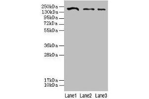 Western blot All lanes: CLTCL1 antibody at 2 μg/mL Lane 1: Jurkat whole cell lysate Lane 2: NIH/3T3 whole cell lysate Lane 3: A431 whole cell lysate Secondary Goat polyclonal to rabbit IgG at 1/10000 dilution Predicted band size: 188, 181 kDa Observed band size: 188 kDa (CLTCL1 anticorps  (AA 1423-1566))