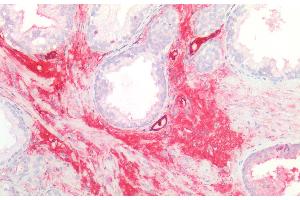 Detection of GLMP in Human Prostate Tissue using Polyclonal Antibody to Glycosylated Lysosomal Membrane Protein (GLMP)