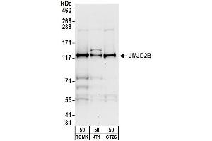 anti-Lysine (K)-Specific Demethylase 4B (KDM4B) (AA 1056-1096) antibody