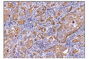 IHC analysis of DHPS/DHS using anti-DHPS/DHS antibody (ABIN7601998). (DHPS anticorps  (AA 54-358))