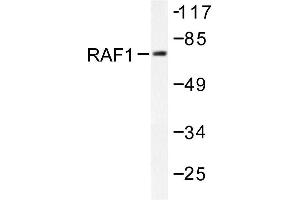 Image no. 1 for anti-V-Raf-1 Murine Leukemia Viral Oncogene Homolog 1 (RAF1) antibody (ABIN271937) (RAF1 anticorps)