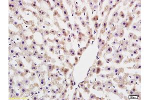 Formalin-fixed and paraffin embedded rat colitis labeled with Anti COLEC10(LIVER) Polyclonal Antibody, Unconjugated (ABIN872637) at 1:200 followed by conjugation to the secondary antibody and DAB staining (COLEC10 anticorps  (AA 151-230))