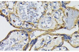 Immunohistochemistry of paraffin-embedded Human placenta using IQGAP1 Polyclonal Antibody at dilution of 1:200 (40x lens). (IQGAP1 anticorps)