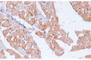 Immunohistochemistry of paraffin-embedded Rat heart using ARRB1 Polyclonal Antibody at dilution of 1:100 (40x lens).