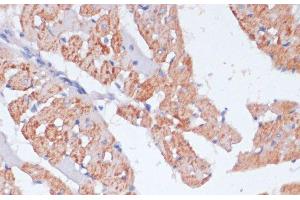 Immunohistochemistry of paraffin-embedded Rat heart using ARRB1 Polyclonal Antibody at dilution of 1:100 (40x lens). (beta Arrestin 1 anticorps)