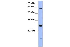 WB Suggested Anti-MSH6 Antibody Titration:  0.