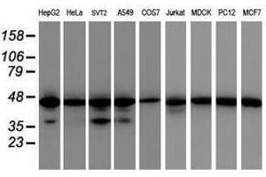 Image no. 1 for anti-Isocitrate Dehydrogenase 1 (NADP+), Soluble (IDH1) antibody (ABIN1502107) (IDH1 anticorps)