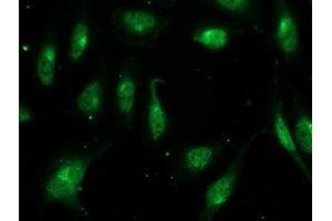 Immunofluorescent staining of HeLa cells using anti-FGF21 mouse monoclonal antibody (ABIN2454474). (FGF21 anticorps  (AA 29-209))