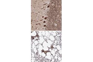 Immunohistochemical staining of human bone marrow with KIF4A polyclonal antibody  shows strong nuclear positivity in hematopoietic cells at 1:50-1:200 dilution. (KIF4A anticorps)