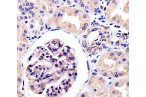 IHC testing of FFPE human kidney tissue with ROR1 antibody at 1:25 dilution.