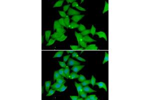 Immunofluorescence analysis of U20S cell using STK3 antibody. (STK3 anticorps)