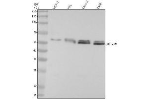 Western blot analysis of ZNF259 using anti-ZNF259 antibody (ABIN7606743).