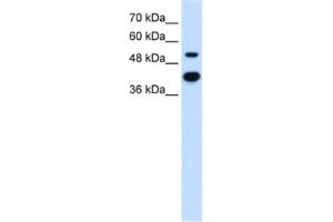 Western Blotting (WB) image for anti-Matrix Metallopeptidase 1 (Interstitial Collagenase) (MMP1) antibody (ABIN2462518) (MMP1 anticorps)