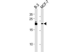 Western Blotting (WB) image for anti-Chromosome 13 Open Reading Frame 30 (C13orf30) antibody (ABIN3004687) (C13orf30 anticorps)