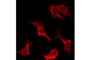 ABIN6276906 staining HuvEc by IF/ICC. (IL-10RA anticorps  (C-Term))