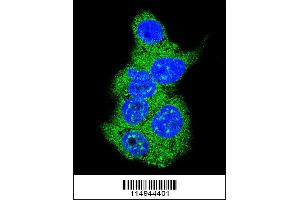 anti-Aldolase (ALD) (AA 66-95), (N-Term) antibody