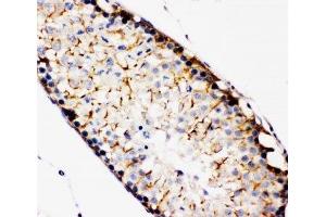 IHC-P: TBK1 antibody testing of rat testis tissue (TBK1 anticorps  (C-Term))