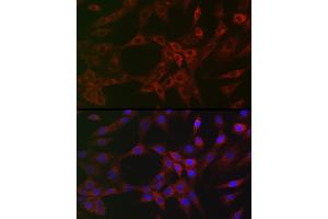 Immunofluorescence analysis of NIH/3T3 cells using  Rabbit mAb (ABIN7265385) at dilution of 1:100 (40x lens).