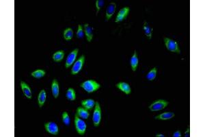 Immunofluorescent analysis of A549 cells using ABIN7163589 at dilution of 1:100 and Alexa Fluor 488-congugated AffiniPure Goat Anti-Rabbit IgG(H+L)