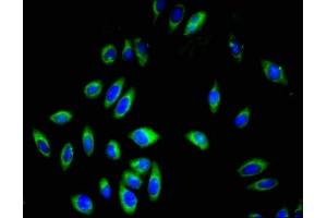 Immunofluorescent analysis of A549 cells using ABIN7163589 at dilution of 1:100 and Alexa Fluor 488-congugated AffiniPure Goat Anti-Rabbit IgG(H+L) (CD42a anticorps  (AA 17-88))