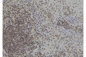 ABIN6278307 at 1/100 staining Human spleen tissue by IHC-P. (BACH1 anticorps  (Internal Region))
