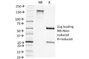SDS-PAGE Analysis Purified CD11c Mouse Monoclonal Antibody (ITGAX/1242). (CD11c anticorps  (AA 637-827))