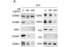 PB downregulates several proteins related to cell cycle progression, morphology, cell-cell adhesion and cell migration.