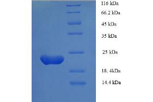 SDS-PAGE (SDS) image for Zinc Finger Protein GLI1 (GLI1) (AA 921-1106), (partial) protein (His tag) (ABIN5712830)