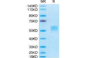 Human CD79B on Tris-Bis PAGE under reduced conditions. (CD79b Protein (AA 29-159) (Fc Tag))