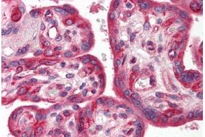 Human Placenta (formalin-fixed, paraffin-embedded) stained with SKIL antibody ABIN214478 at 2. (SKIL anticorps  (N-Term))