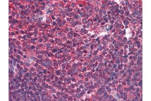 Human Tonsil: Formalin-Fixed, Paraffin-Embedded (FFPE) (BIRC3 anticorps)