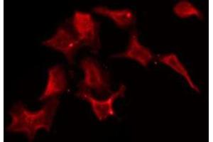 ABIN6275585 staining HuvEc by IF/ICC.