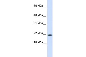 WB Suggested Anti-GABARAPL2 Antibody Titration: 0.
