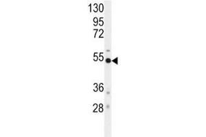 Western blot analysis of BACE antibody and mouse cerebellum tissue lysate.
