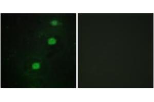 Immunofluorescence analysis of HuvEc cells, using CCRK Antibody.