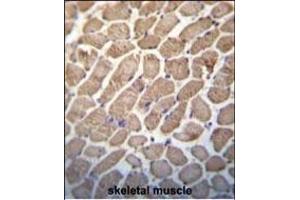 Hamartin (TSC1) Antibody (Center) (ABIN652207 and ABIN2840760) immunohistochemistry analysis in formalin fixed and paraffin embedded human skeletal muscle followed by peroxidase conjugation of the secondary antibody and DAB staining.