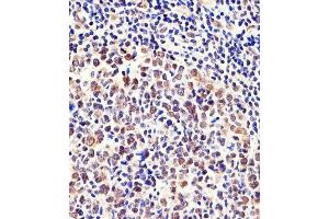 anti-Chromosome Segregation 1-Like (CSE1L) (AA 55-84), (N-Term) antibody