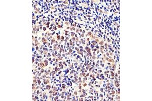 Immunohistochemical analysis of paraffin-embedded H. (CSE1L anticorps  (N-Term))