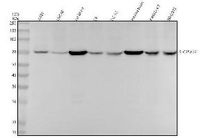 Western blot analysis of SLC25A12 using anti-SLC25A12 antibody (ABIN7606307).