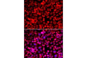 Immunofluorescence analysis of A549 cells using ANLN antibody (ABIN5973909). (Anillin anticorps)