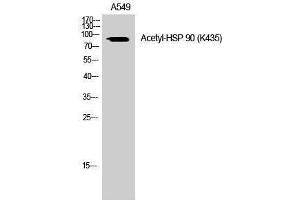 Western Blotting (WB) image for anti-Heat Shock Protein 90 (HSP90) (acLys435) antibody (ABIN3172836) (HSP90 anticorps  (acLys435))