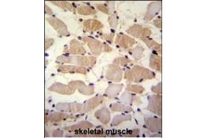 SUSD5 Antibody (C-term) (ABIN655447 and ABIN2844977) immunohistochemistry analysis in formalin fixed and paraffin embedded human skeletal muscle followed by peroxidase conjugation of the secondary antibody and DAB staining. (SUSD5 anticorps  (C-Term))