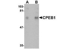 Image no. 1 for anti-Cytoplasmic Polyadenylation Element Binding Protein 1 (CPEB1) (N-Term) antibody (ABIN342681) (CPEB1 anticorps  (N-Term))