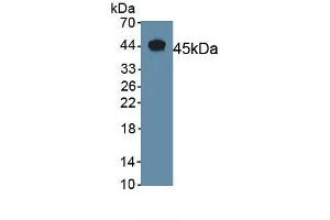 Detection of Recombinant CGRP, Mouse using Polyclonal Antibody to Calcitonin Gene Related Peptide (CGRP) (CGRP anticorps  (AA 1-130))