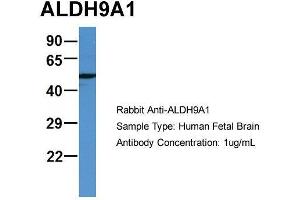 Host: Rabbit  Target Name: ALDH9A1  Sample Tissue: Human Fetal Brain  Antibody Dilution: 1.
