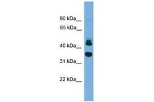 Image no. 1 for anti-Sorting Nexin 32 (SNX32) (AA 251-300) antibody (ABIN6745574) (SNX32 anticorps  (AA 251-300))
